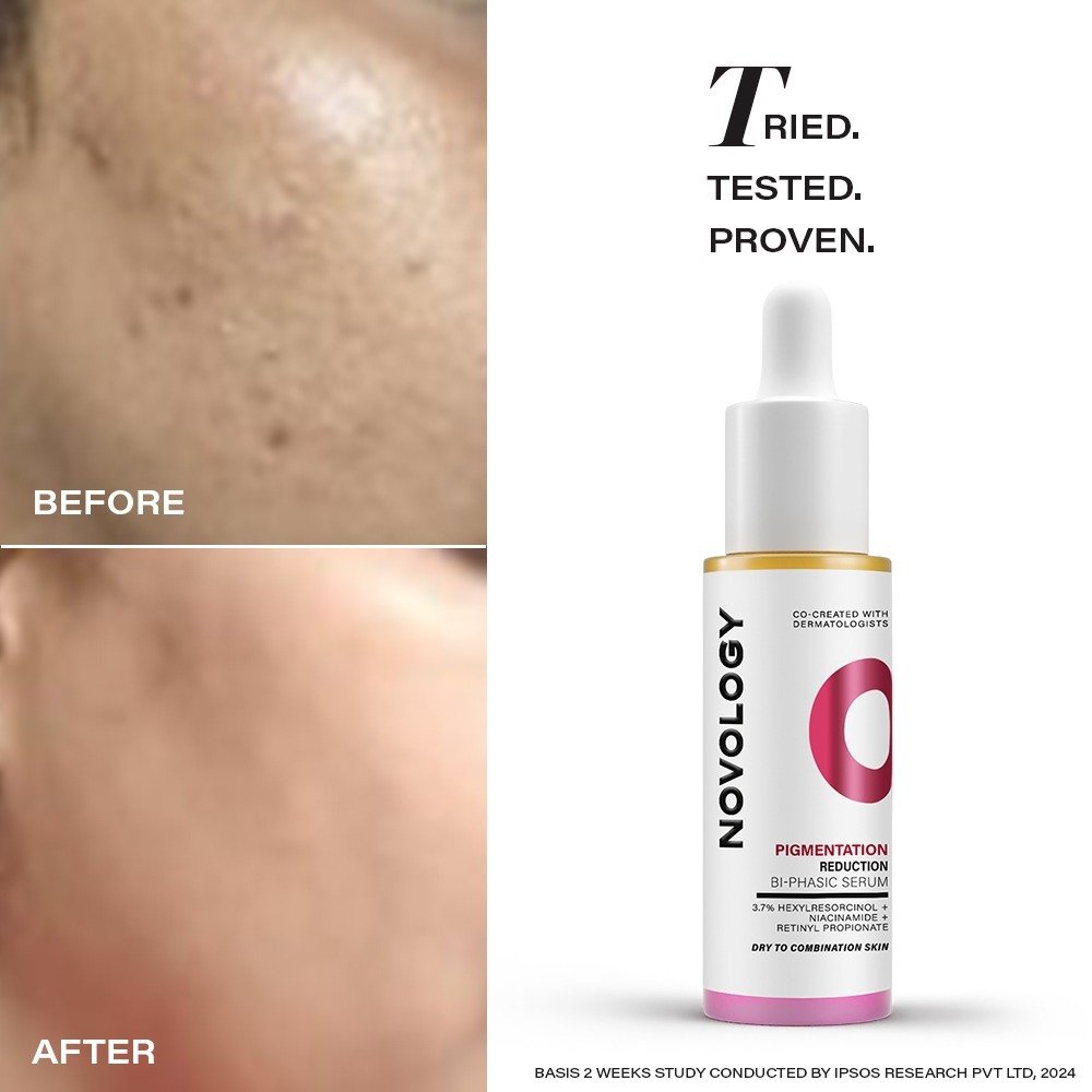 Novology Pigmentation Reduction Bi-Phasic Serum, 28 ml, Pack of 1 Novology Pigmentation Reduction Bi-Phasic Serum, 28 ml, Pack of 1