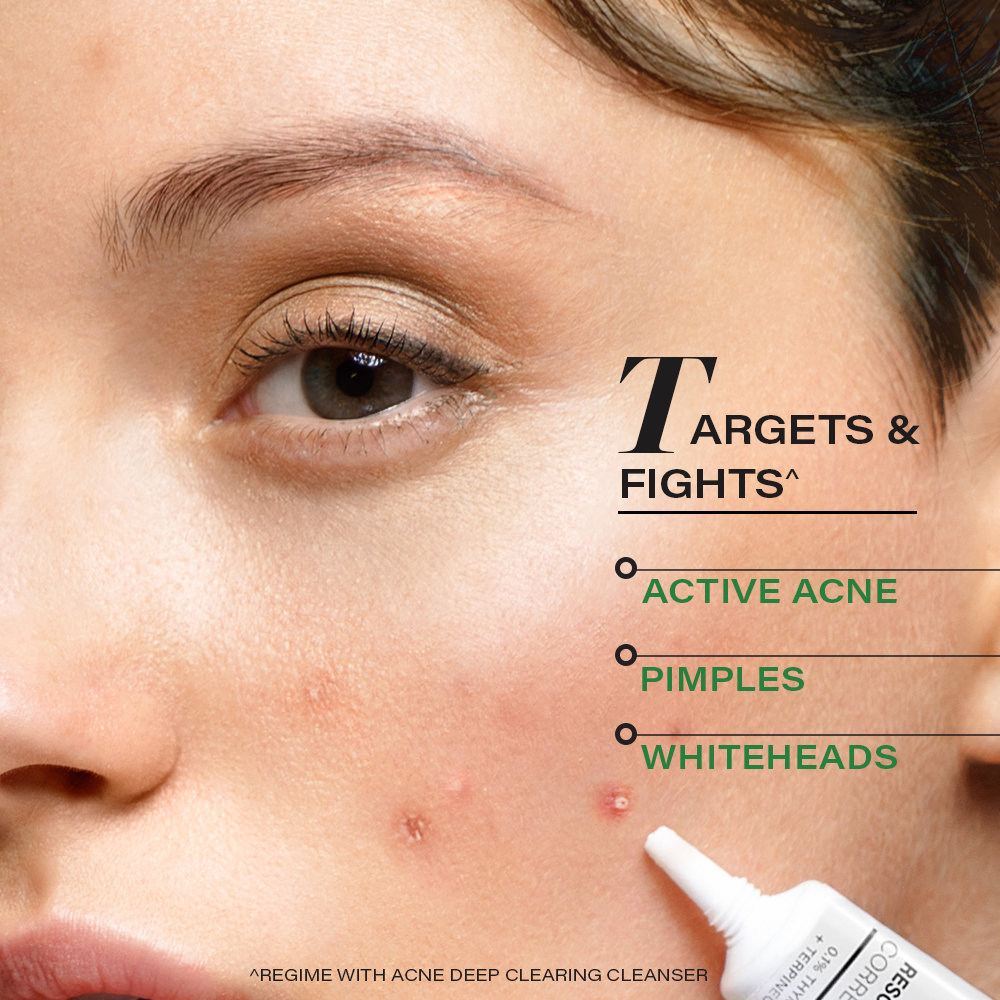 Novology Acne Rescue Spot Corrector, 30 gm, Pack of 1 Novology Acne Rescue Spot Corrector, 30 gm, Pack of 1