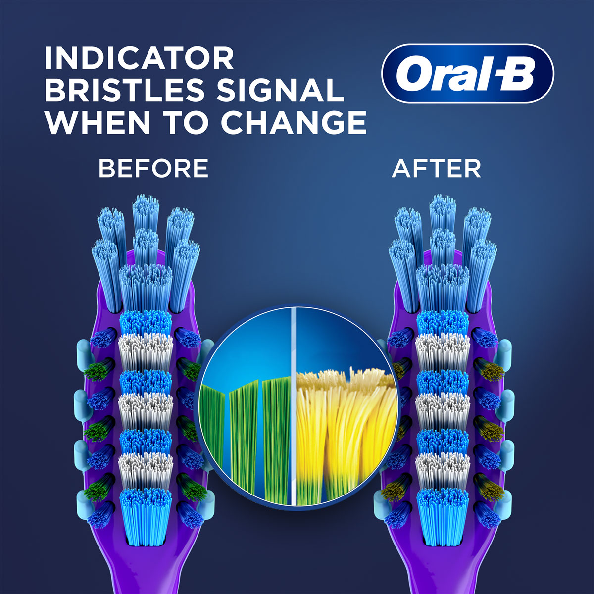 Oral-B Criss Cross Deep Clean Gum Care Soft Toothbrush, 4 (Buy 2 , Get 2 Free), Pack of 1 Oral-B Criss Cross Deep Clean Gum Care Soft Toothbrush, 4 (Buy 2 , Get 2 Free), Pack of 1