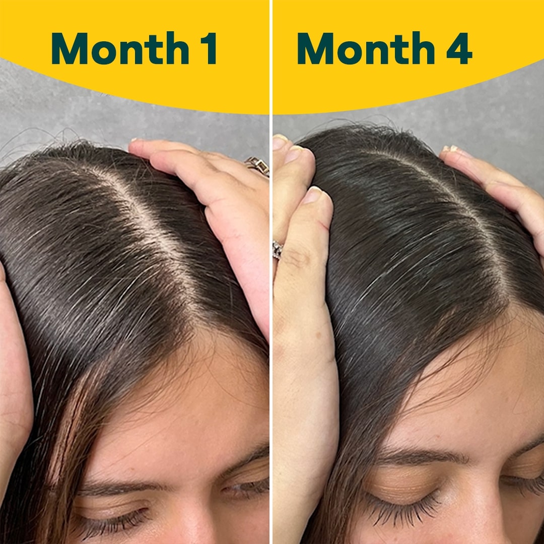 OZiva Hair Vitamins with Biotin, Vitamin E & Iron for Hair Re-growth & Hairfall Control, 60 Capsules, Pack of 1 OZiva Hair Vitamins with Biotin, Vitamin E & Iron for Hair Re-growth & Hairfall Control, 60 Capsules, Pack of 1