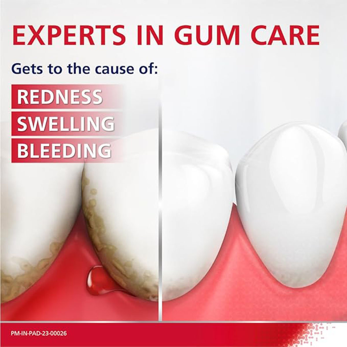 Parodontax Daily Fluoride Toothpaste, 75 gm, Pack of 1 Parodontax Daily Fluoride Toothpaste, 75 gm, Pack of 1