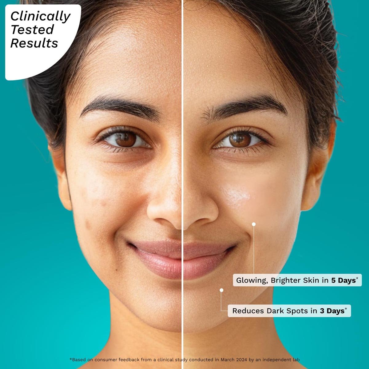 Pilgrim 10% Vitamin C Face Serum, 30 ml, Pack of 1 Pilgrim 10% Vitamin C Face Serum, 30 ml, Pack of 1