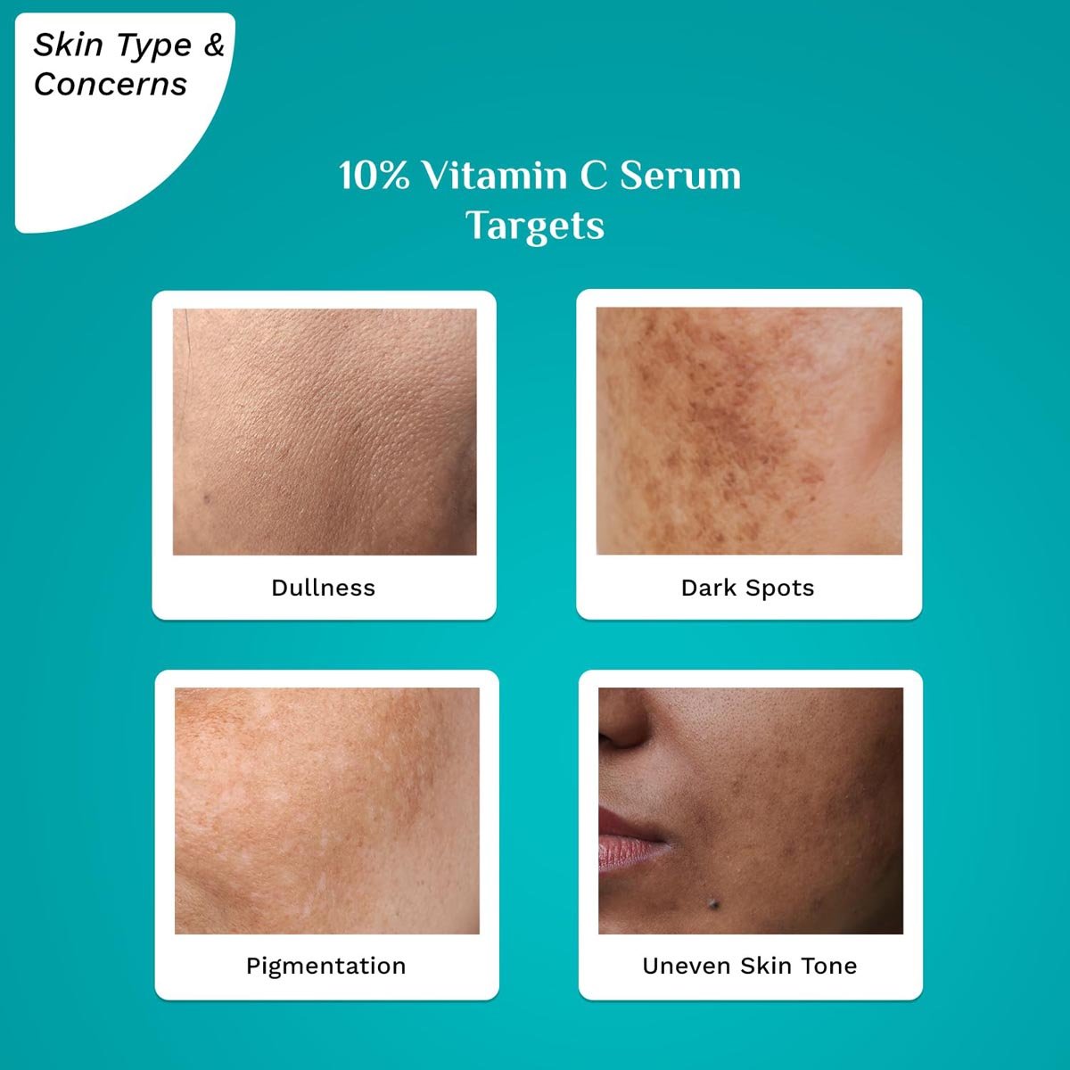 Pilgrim 10% Vitamin C Face Serum, 30 ml, Pack of 1 Pilgrim 10% Vitamin C Face Serum, 30 ml, Pack of 1