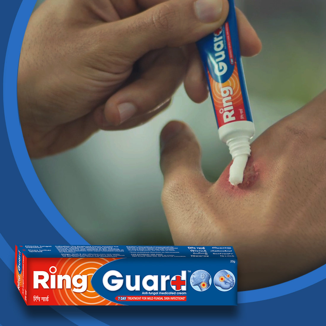Ring Guard Antifungal Medicated Cream, 20 gm, Pack of 1 Ring Guard Antifungal Medicated Cream, 20 gm, Pack of 1