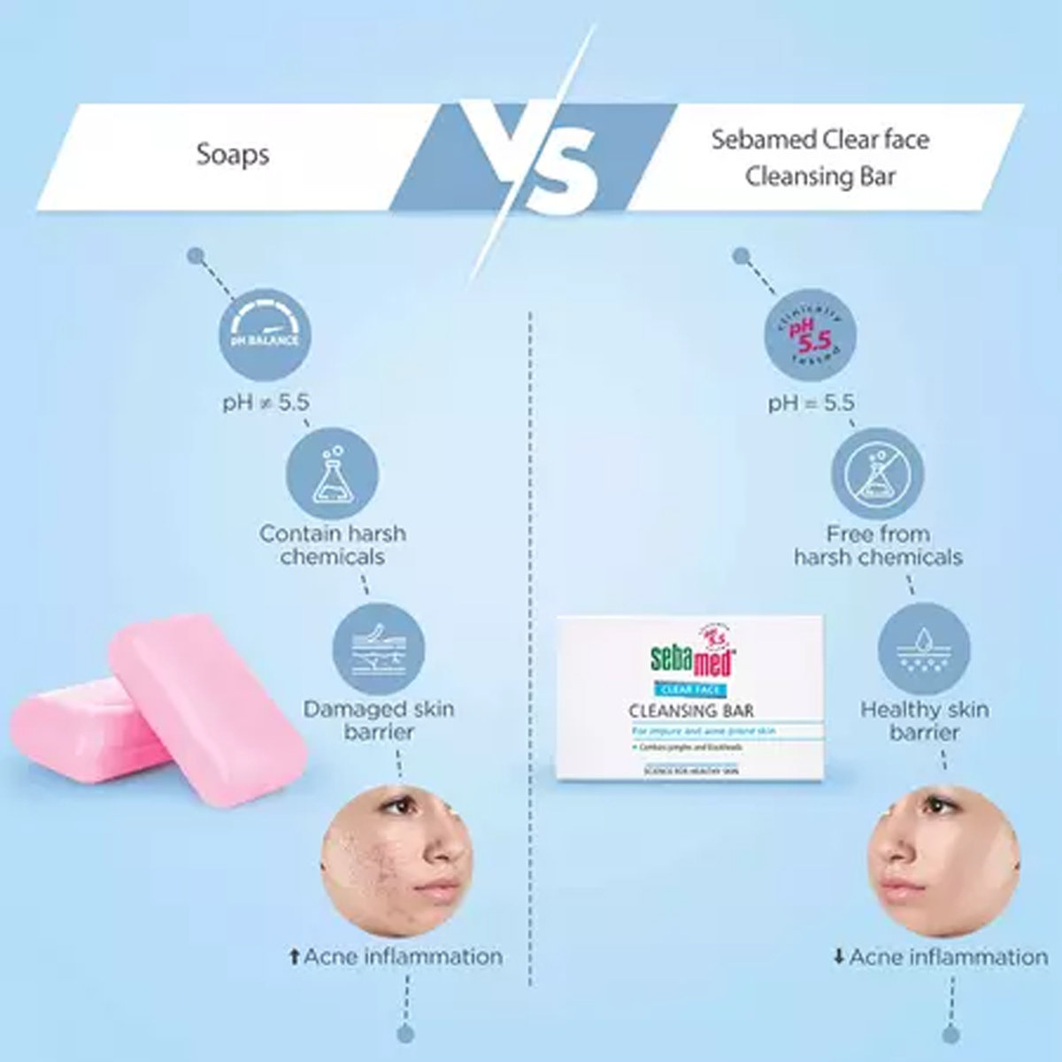 Sebamed Clear Face Cleansing Bar 100 gm | Combats Pimples & Blackheads | pH 5.5 | For Impure & Acne Prone Skin, Pack of 1 Sebamed Clear Face Cleansing Bar 100 gm | Combats Pimples & Blackheads | pH 5.5 | For Impure & Acne Prone Skin, Pack of 1