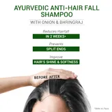Sesa Ayurvedic Anti-Hair Fall Shampoo with Bhringraj &amp; Onion, 200 ml, Pack of 1