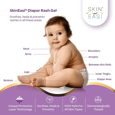 SkinEasi Baby Diaper Rash Gel, 25 gm, Pack of 1