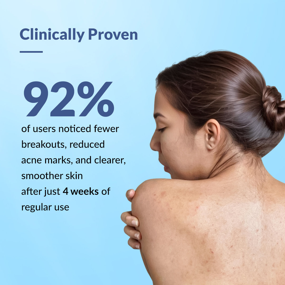 Fixderma Salyzap-Az Body Spray, 100 ml, Pack of 1 Fixderma Salyzap-Az Body Spray, 100 ml, Pack of 1