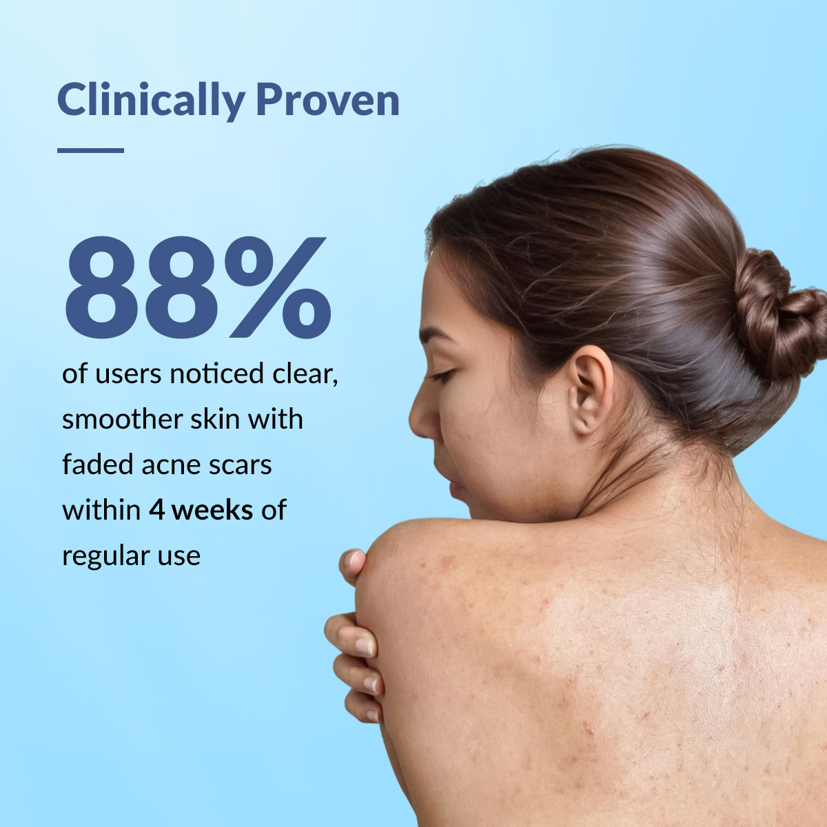 Fixderma Salyzap Body Wash, 200 ml, Pack of 1 Fixderma Salyzap Body Wash, 200 ml, Pack of 1