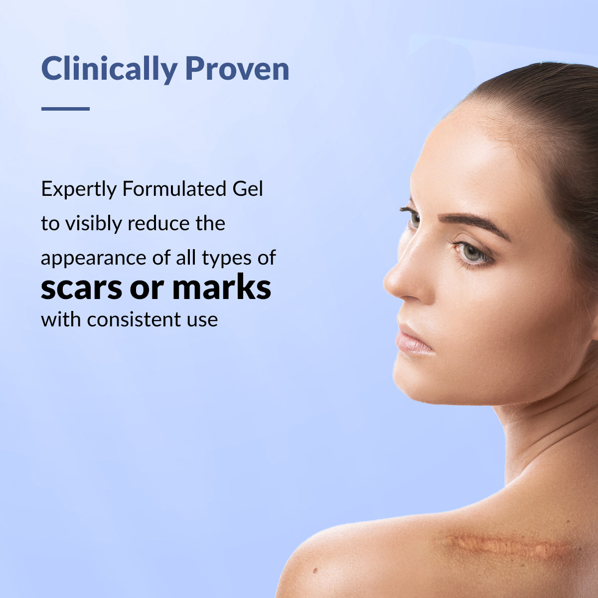 Fixderma Scar Gel, 15 ml, Pack of 1 Fixderma Scar Gel, 15 ml, Pack of 1
