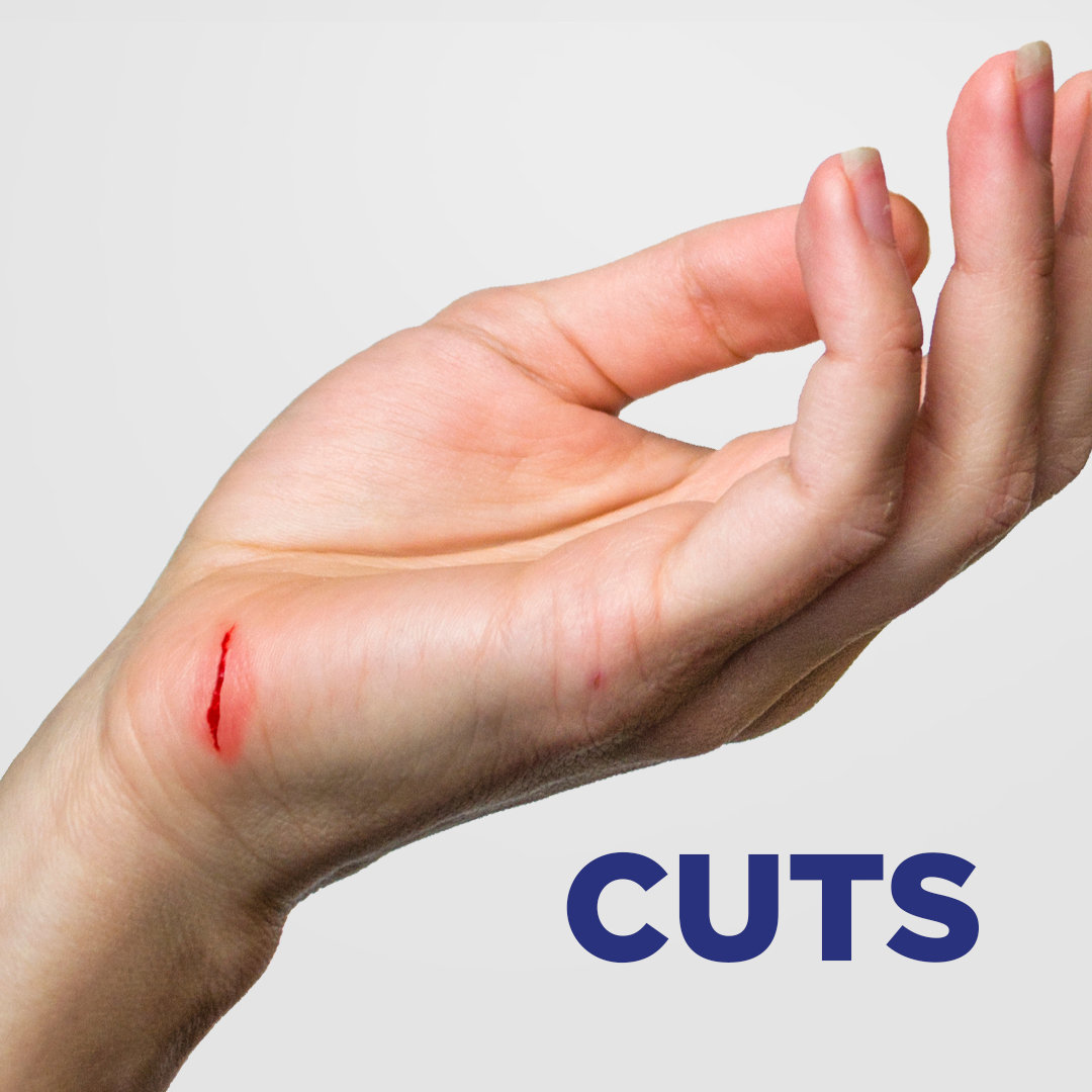 Soframycin Multi-Purpose Antiseptic Cream for Cuts, Wounds, Burns & Skin Infections, 100 gm, Pack of 1 CREAM Soframycin Multi-Purpose Antiseptic Cream for Cuts, Wounds, Burns & Skin Infections, 100 gm, Pack of 1 CREAM