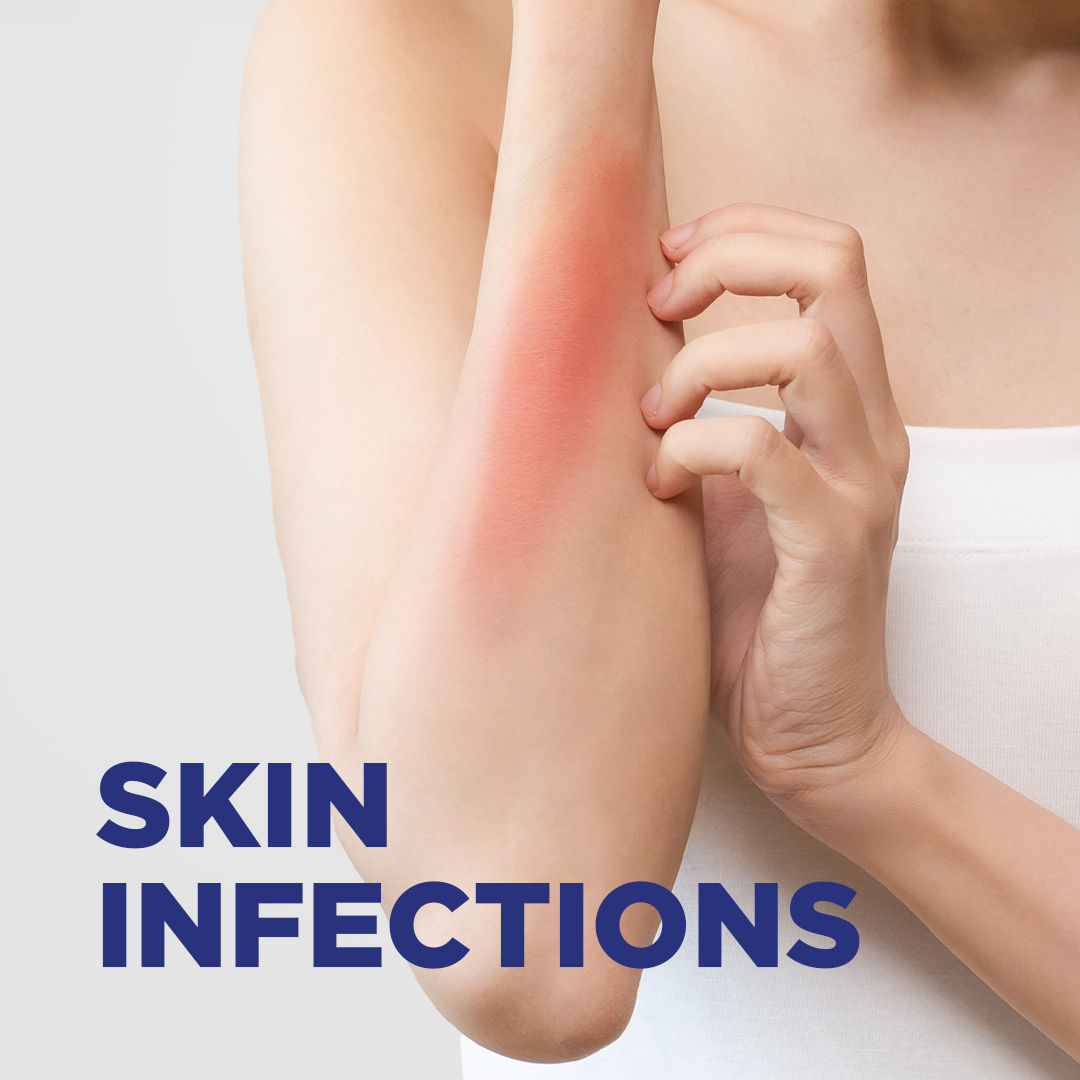 Soframycin Multi-Purpose Antiseptic Cream for Cuts, Wounds, Burns & Skin Infections, 100 gm, Pack of 1 CREAM Soframycin Multi-Purpose Antiseptic Cream for Cuts, Wounds, Burns & Skin Infections, 100 gm, Pack of 1 CREAM