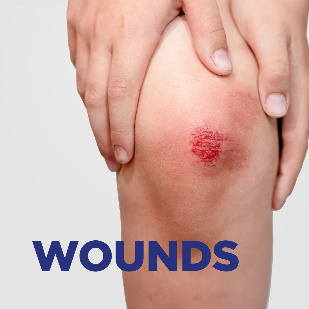 Soframycin Multi-Purpose Antiseptic Cream for Cuts, Wounds, Burns & Skin Infections, 100 gm, Pack of 1 CREAM Soframycin Multi-Purpose Antiseptic Cream for Cuts, Wounds, Burns & Skin Infections, 100 gm, Pack of 1 CREAM