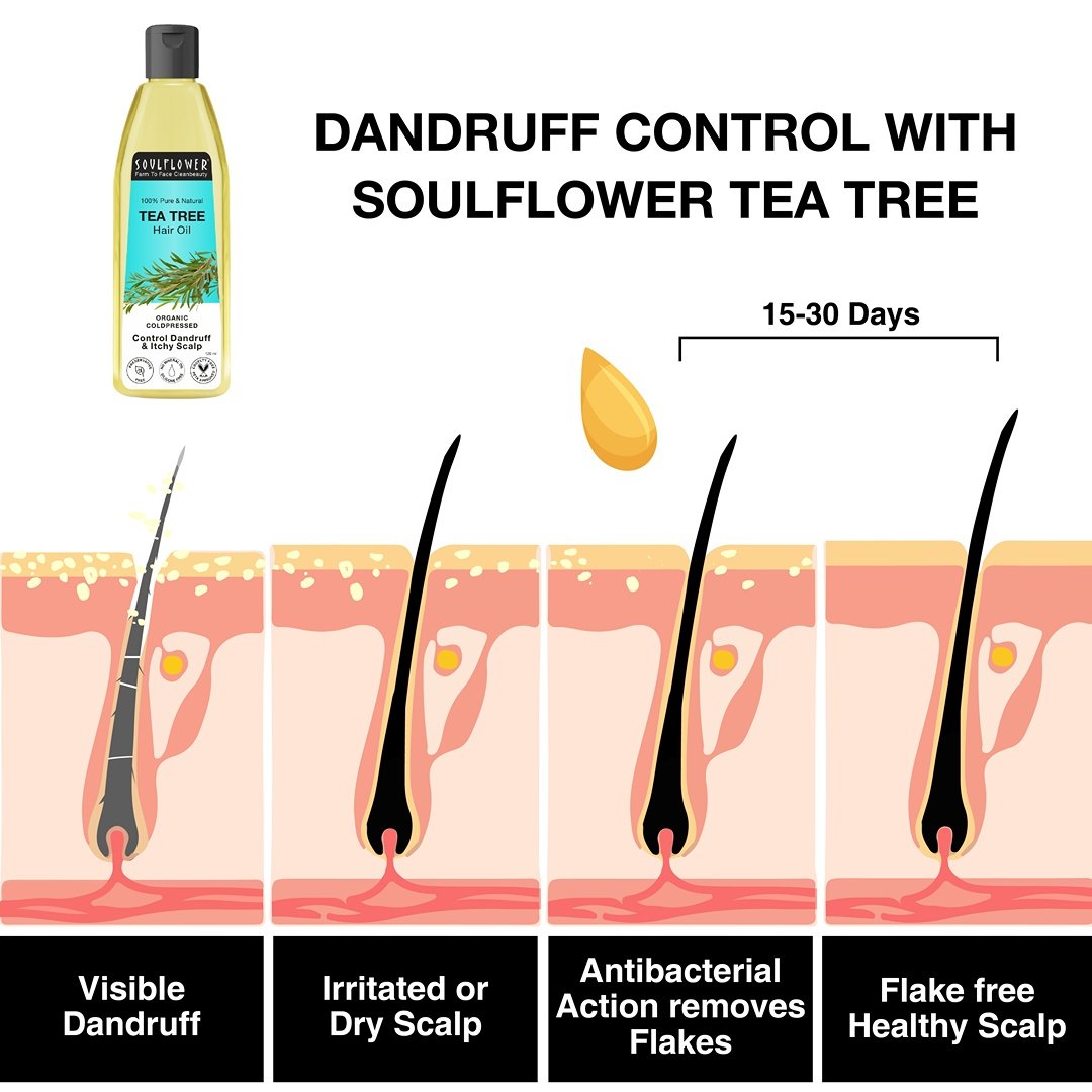 Soulflower Tea Tree Hair Oil for Dandruff & Itchy Scalp, 120 ml, Pack of 1 Soulflower Tea Tree Hair Oil for Dandruff & Itchy Scalp, 120 ml, Pack of 1