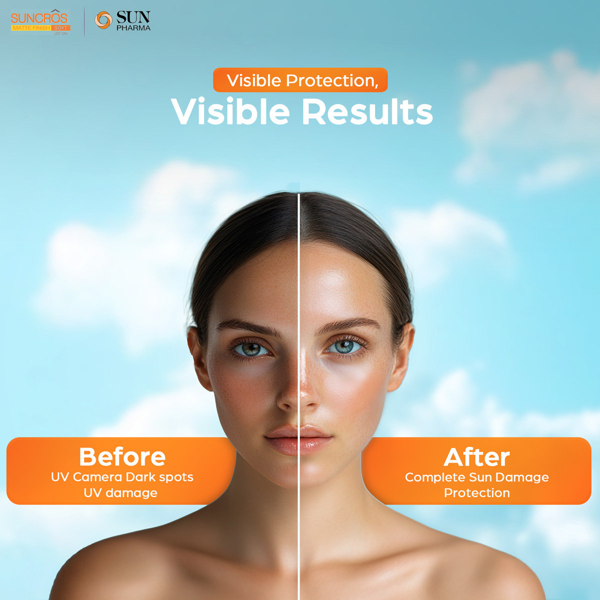 Suncros Matte Finish Soft Lotion SPF 50+ PA+++, 60 ml, Pack of 1 Ointment Suncros Matte Finish Soft Lotion SPF 50+ PA+++, 60 ml, Pack of 1 Ointment