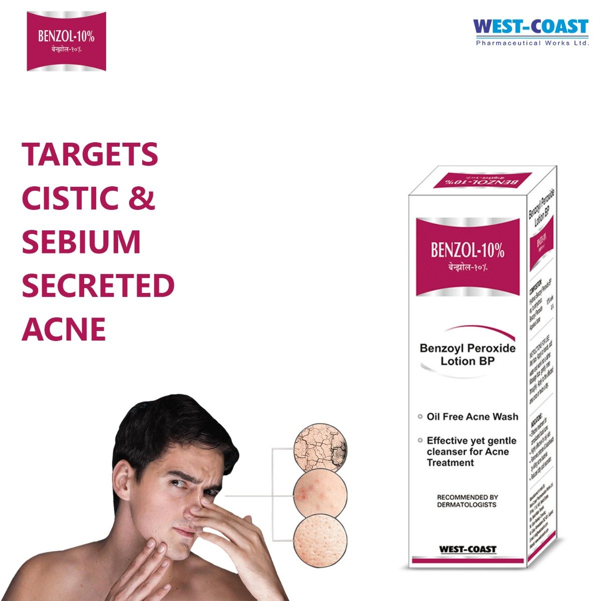 West-Coast Benzol-10% Face Wash 100 gm, Pack of 1 Face Wash West-Coast Benzol-10% Face Wash 100 gm, Pack of 1 Face Wash