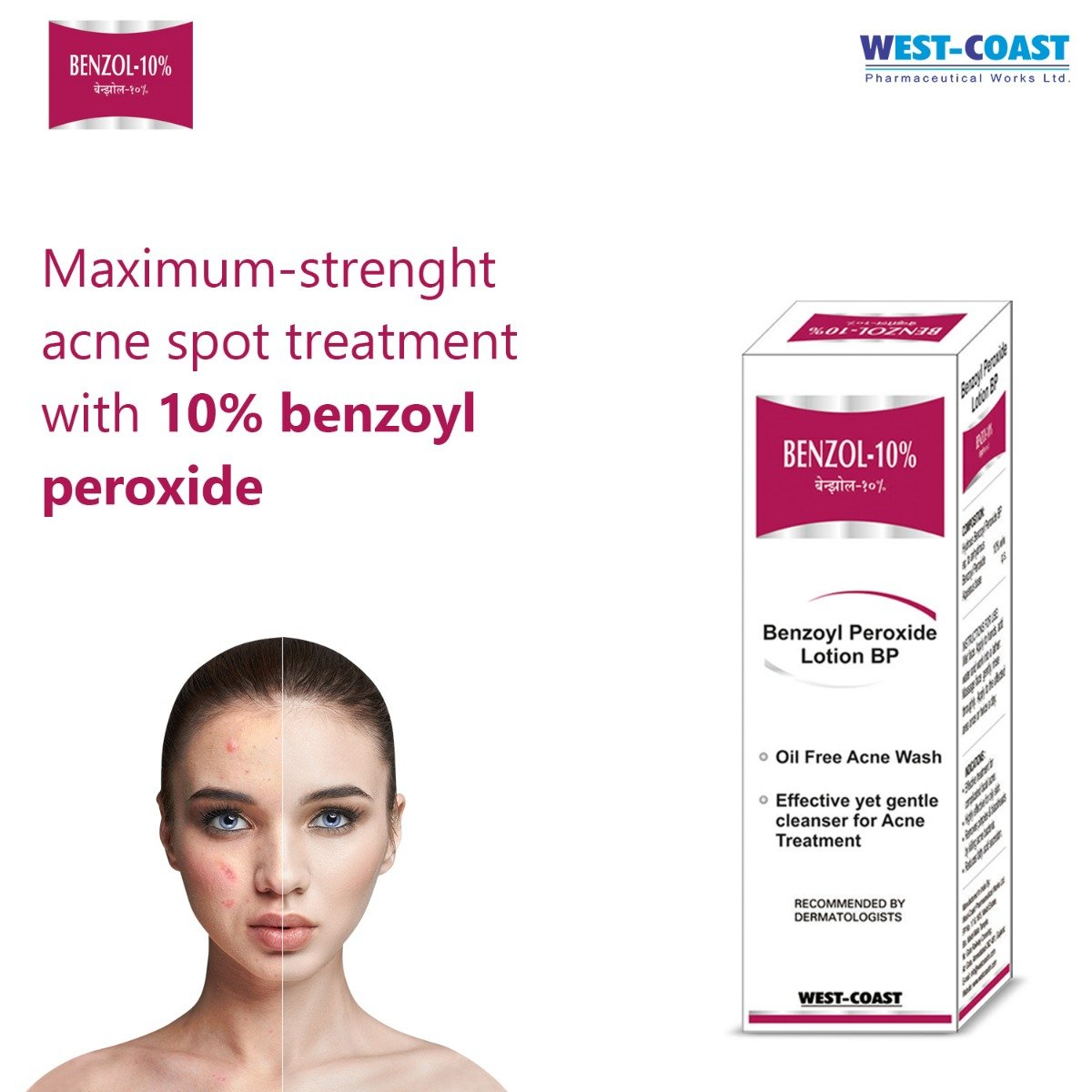 West-Coast Benzol-10% Face Wash 100 gm, Pack of 1 Face Wash West-Coast Benzol-10% Face Wash 100 gm, Pack of 1 Face Wash
