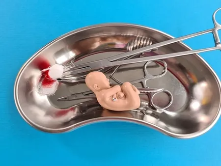 artricle image