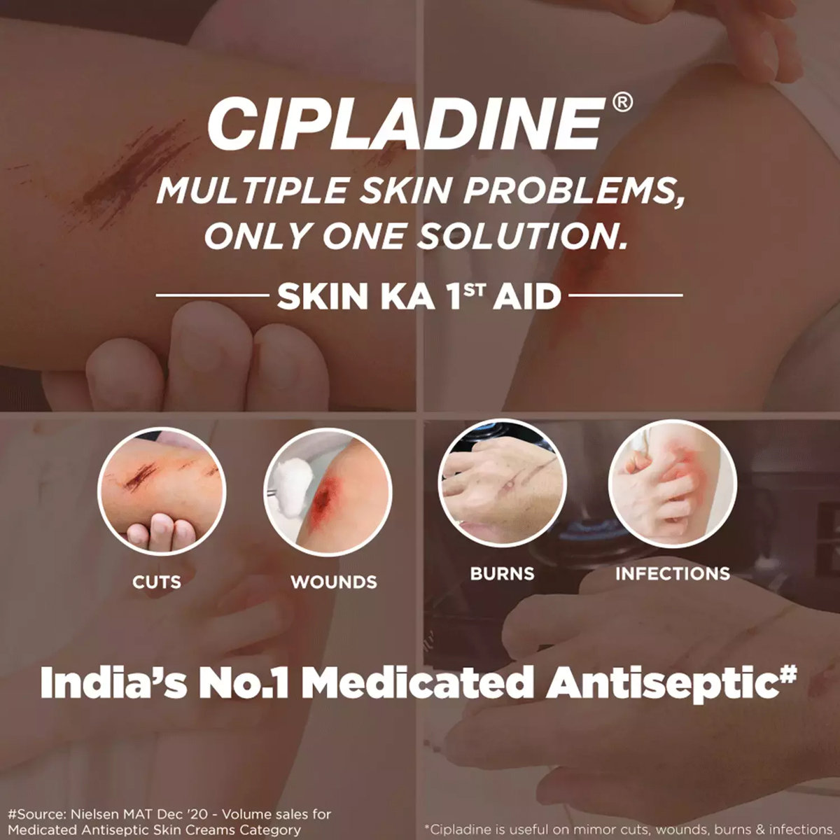 Cipladine 5% Ointment 250 gm, Pack of 1 Ointment Cipladine 5% Ointment 250 gm, Pack of 1 Ointment