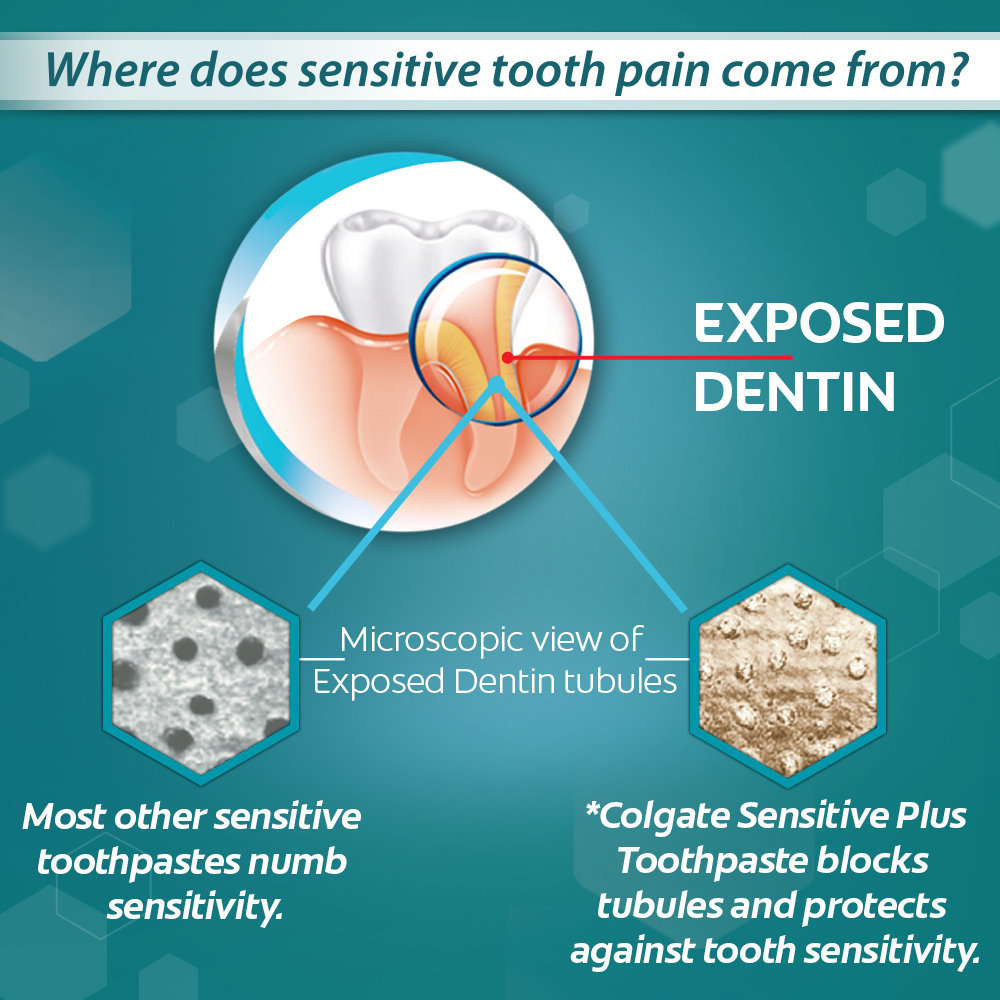 Colgate Sensitive Plus Anticavity Toothpaste, 70 gm, Pack of 1 Colgate Sensitive Plus Anticavity Toothpaste, 70 gm, Pack of 1