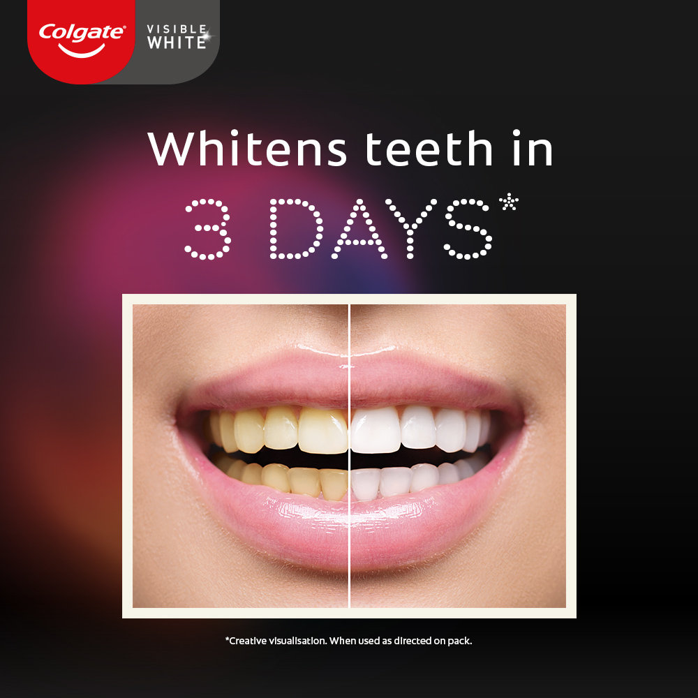 Colgate Visible White O2 Whitening Peppermint Sparkle Toothpaste, 50 gm, Pack of 1 Colgate Visible White O2 Whitening Peppermint Sparkle Toothpaste, 50 gm, Pack of 1