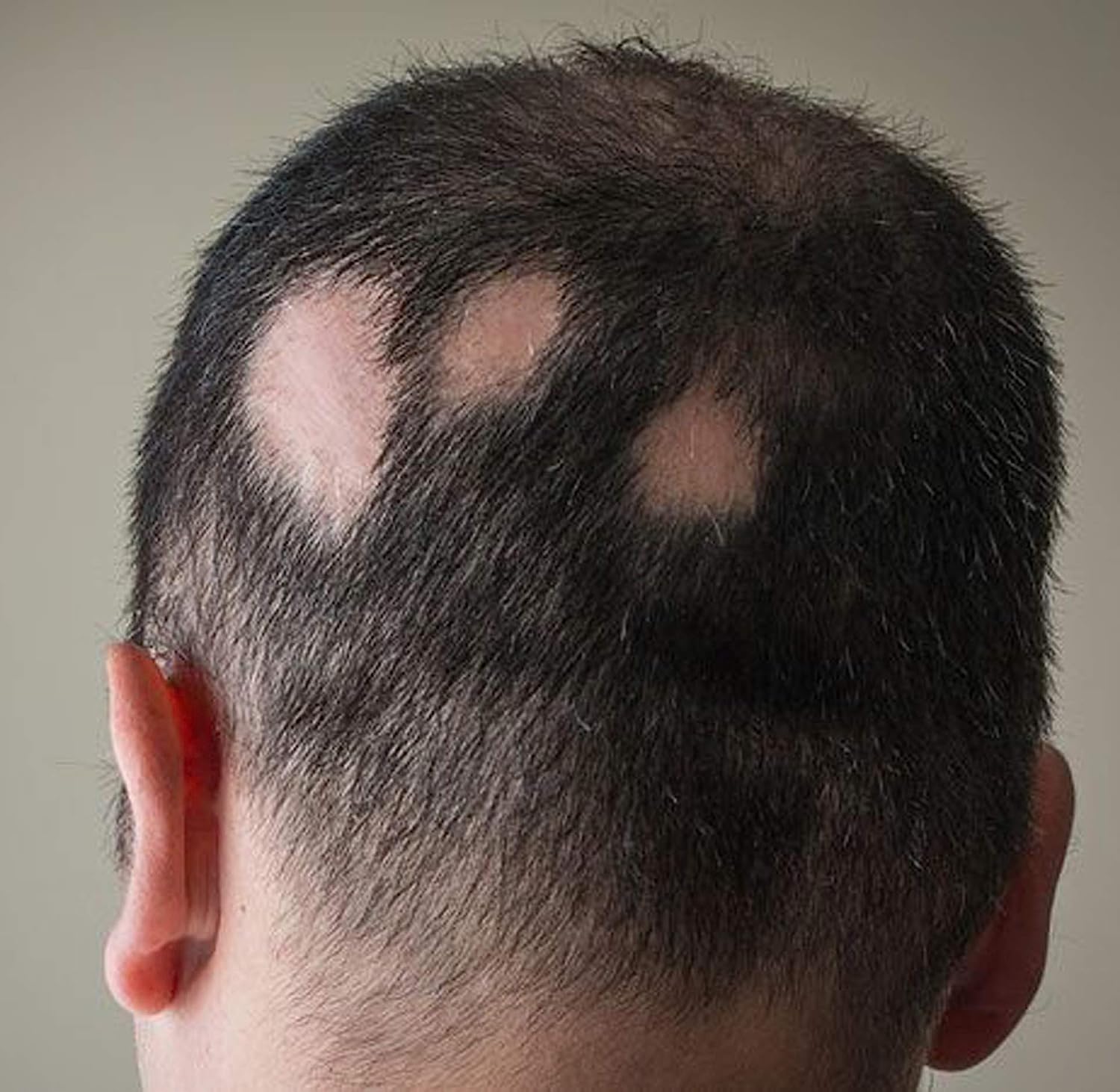 Entik Hair Vitalizer, 200 ml, Pack of 1 Entik Hair Vitalizer, 200 ml, Pack of 1