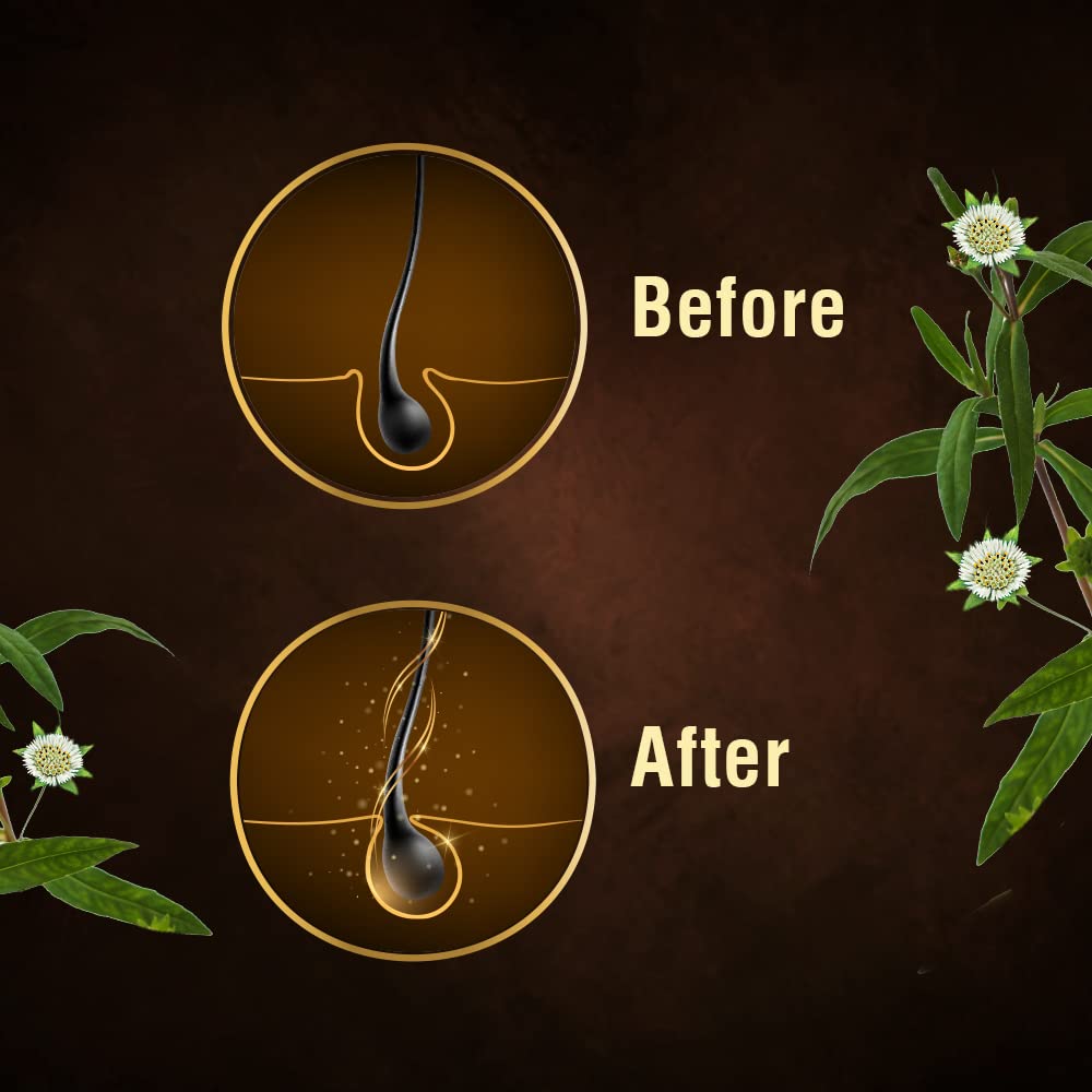 Indulekha Bringha Hair Strengthening Serum, 30 ml, Pack of 1 Indulekha Bringha Hair Strengthening Serum, 30 ml, Pack of 1