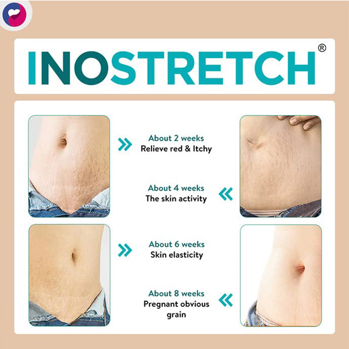 Inostretch Cream 60 gm, Pack of 1 Inostretch Cream 60 gm, Pack of 1