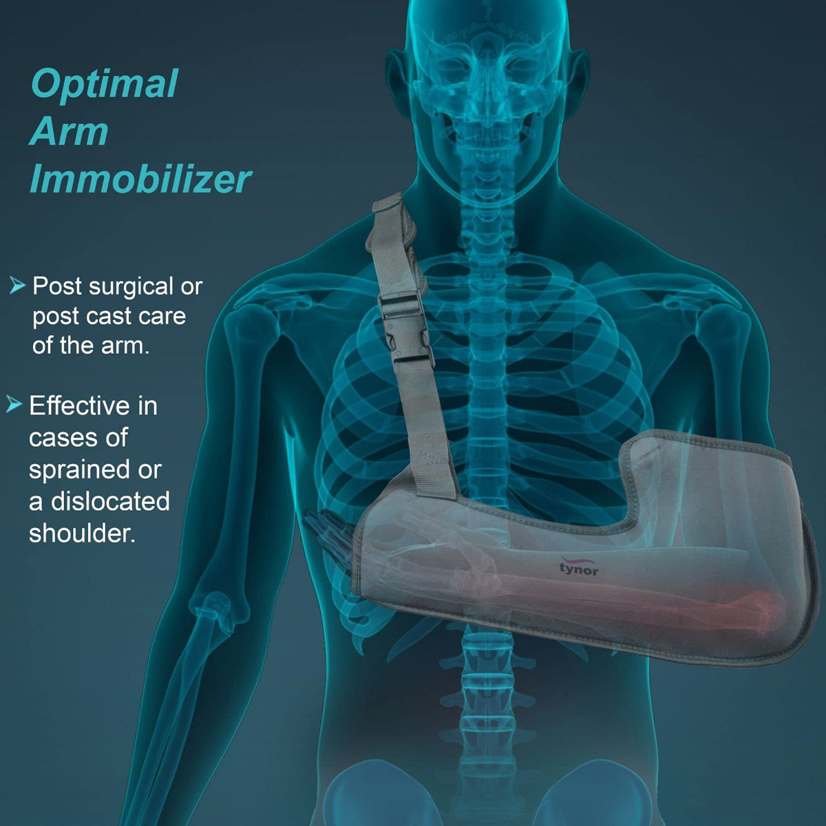 Tynor Arm Sling Tropical Pouch XL, 1 Count, Pack of 1 Tynor Arm Sling Tropical Pouch XL, 1 Count, Pack of 1