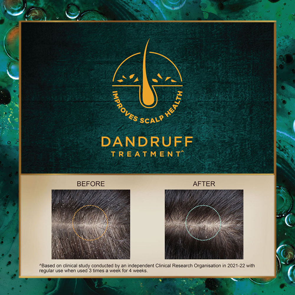 Indulekha Svetakutaja Oil for Dandruff Treatment, 100 ml, Pack of 1 Indulekha Svetakutaja Oil for Dandruff Treatment, 100 ml, Pack of 1