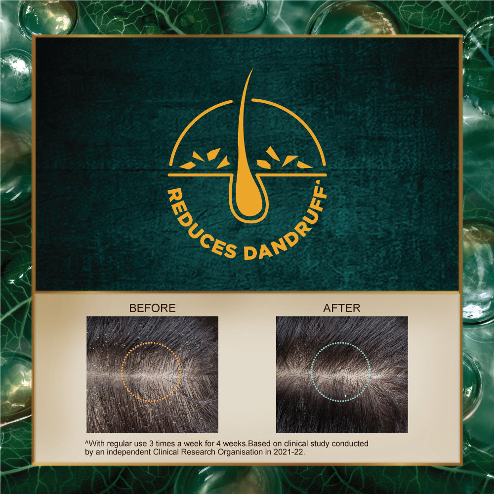 Indulekha Dandruff Treatment Shampoo, 200 ml, Pack of 1 Indulekha Dandruff Treatment Shampoo, 200 ml, Pack of 1