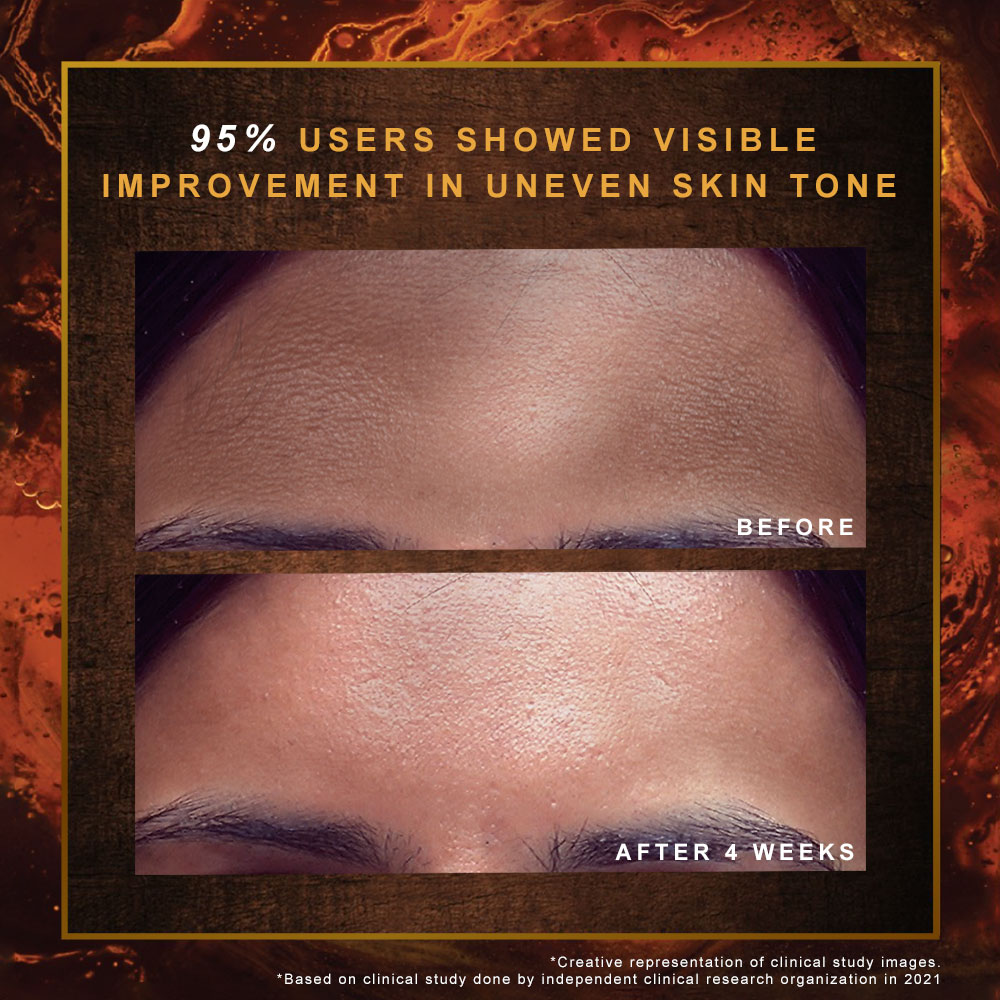 Indulekha Ayurvedic Proprietary Medicinal Soap 100 gm | Manjistha, Yashtimadhu, Matulunga, Laksha, Milk & Coconut Oil | For Dark Spots, Marks & Uneven Skin Tone, Pack of 1 Indulekha Ayurvedic Proprietary Medicinal Soap 100 gm | Manjistha, Yashtimadhu, Matulunga, Laksha, Milk & Coconut Oil | For Dark Spots, Marks & Uneven Skin Tone, Pack of 1