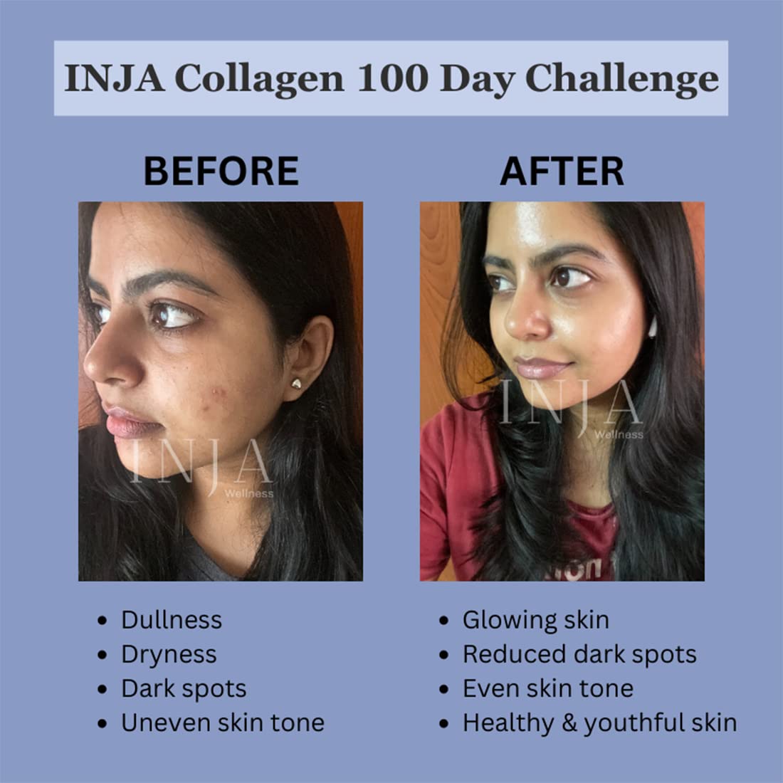 INJA Life Collagen Blueberry Flavour Powder, 150 gm (30 gm x 5 Sachets), Pack of 1 INJA Life Collagen Blueberry Flavour Powder, 150 gm (30 gm x 5 Sachets), Pack of 1