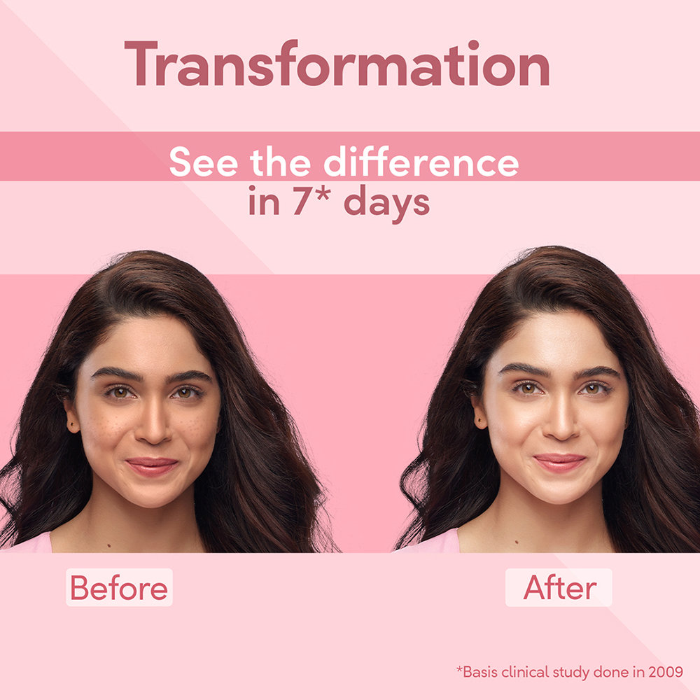 Pond's Bright Beauty Spot-less Glow SPF 15 PA++ Serum Cream, 35 gm, Pack of 1 Pond's Bright Beauty Spot-less Glow SPF 15 PA++ Serum Cream, 35 gm, Pack of 1