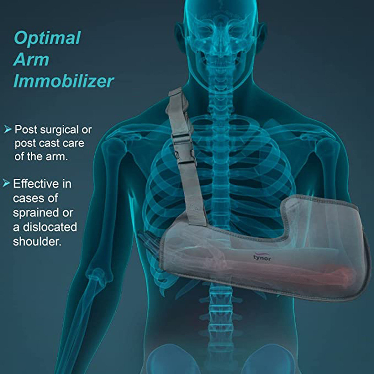 Tynor Arm Sling Pouch Large, 1 Count, Pack of 1 Tynor Arm Sling Pouch Large, 1 Count, Pack of 1