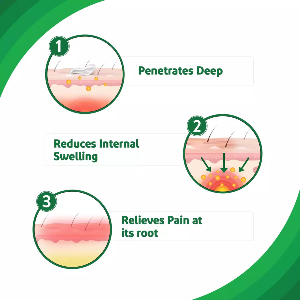Iodex Ultra Gel, 30 gm, Pack of 1 Iodex Ultra Gel, 30 gm, Pack of 1