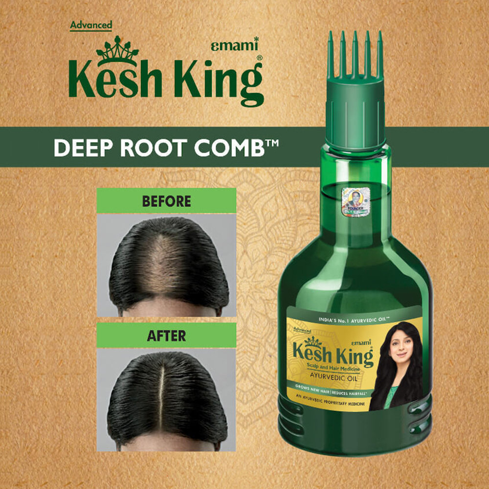 Kesh King Ayurvedic Scalp and Hair Medicine Oil, 300 ml, Pack of 1 Kesh King Ayurvedic Scalp and Hair Medicine Oil, 300 ml, Pack of 1