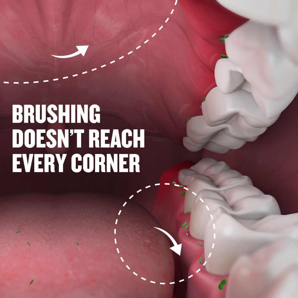 Listerine Cavity Fighter Mouthwash, 80 ml, Pack of 1 Listerine Cavity Fighter Mouthwash, 80 ml, Pack of 1