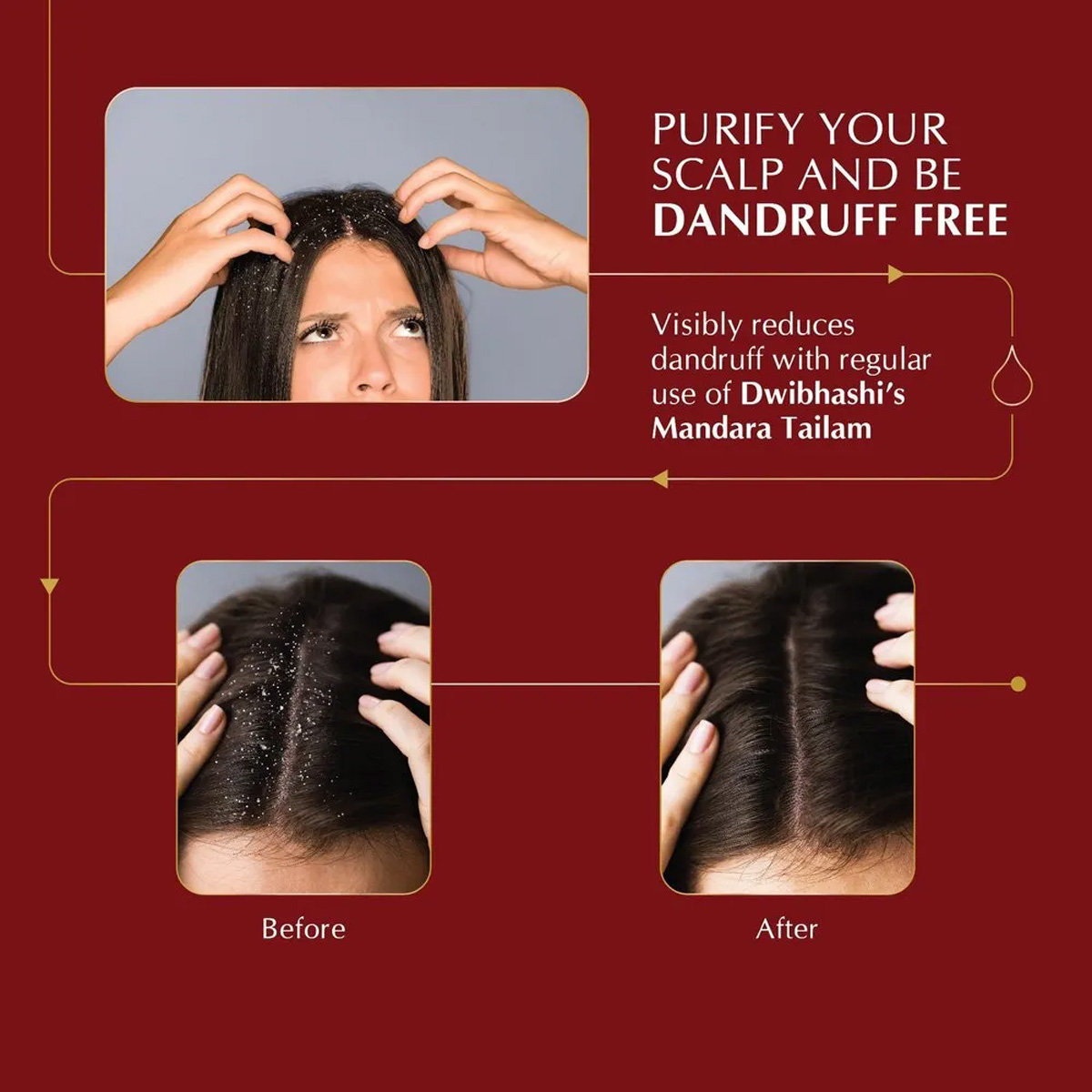 Dwibhashi's Mandara Tailam Hair Oil, 100 ml, Pack of 1 Dwibhashi's Mandara Tailam Hair Oil, 100 ml, Pack of 1