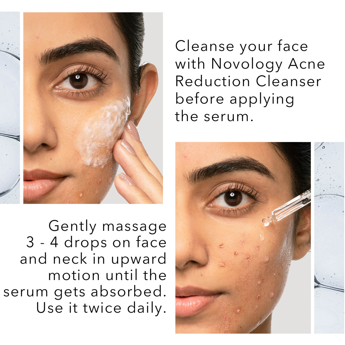 Novology PHA Oily Skin Serum 28 ml | 7% Gluconolactone, Niacinamide | Minimize Oil | For Acne or Oily Skin , All Skin Type, Pack of 1 Novology PHA Oily Skin Serum 28 ml | 7% Gluconolactone, Niacinamide | Minimize Oil | For Acne or Oily Skin , All Skin Type, Pack of 1