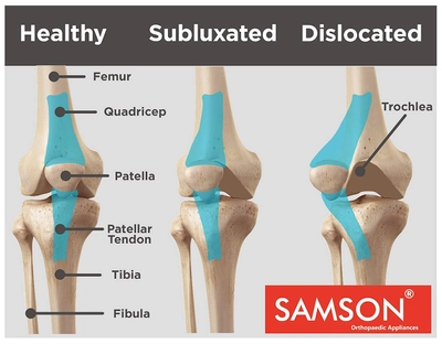 Samson Knee Cap Hinged NE-0619 Large with Patella Gel Pad, 1 Count, Pack of 1