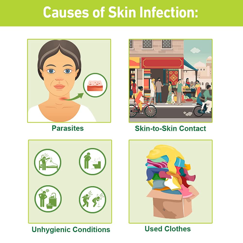 Tetmosol Soap 75 gm | 5%w/w Monosulfiram | Relieves Itching, Redness, Sore & Crusting | Fights Skin Infections, Pack of 1 Tetmosol Soap 75 gm | 5%w/w Monosulfiram | Relieves Itching, Redness, Sore & Crusting | Fights Skin Infections, Pack of 1