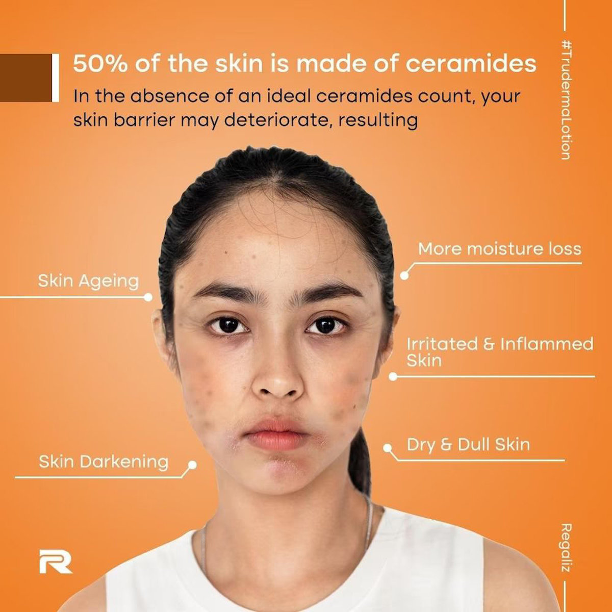 Truderma Moisturizing Lotion 150 ml, Pack of 1 Truderma Moisturizing Lotion 150 ml, Pack of 1