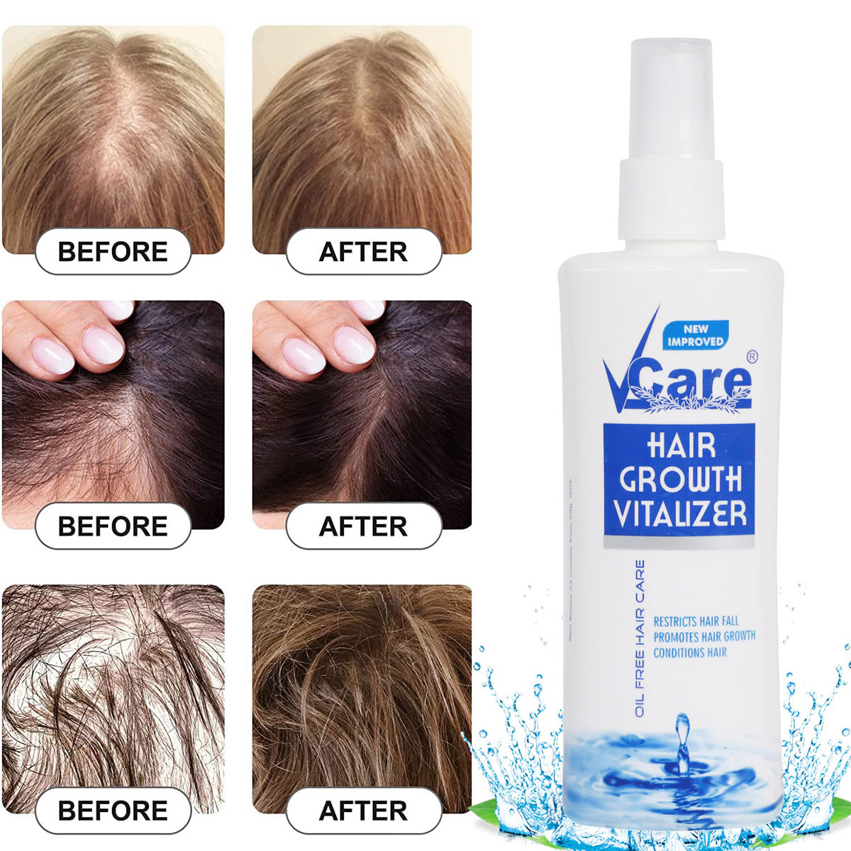 V-Care Hair Growth Vitalizer, 100 ml, Pack of 1 V-Care Hair Growth Vitalizer, 100 ml, Pack of 1